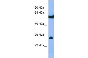Host: Rabbit Target Name: C22orf13 Sample Type: RPMI-8226 Whole Cell lysates Antibody Dilution: 1.