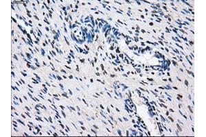 Immunohistochemical staining of paraffin-embedded Ovary tissue using anti-GBE1 mouse monoclonal antibody.