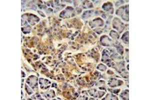 Immunohistochemistry analysis in human pancreas tissue (Formalin-fixed, Paraffin-embedded) using Trypsin-3 / PRSS3  Antibody  (N-term), followed by peroxidase conjugation of the secondary antibody and DAB staining. (PRSS3 antibody  (N-Term))