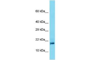 Host: Rabbit Target Name: C8orf42 Sample Type: Placenta lysates Antibody Dilution: 1. (TDRP/C8orf42 antibody  (N-Term))