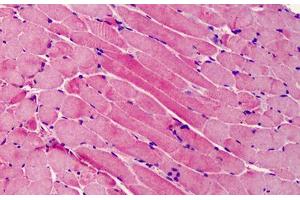 Human Skeletal Muscle: Formalin-Fixed, Paraffin-Embedded (FFPE) (BID antibody  (C-Term))
