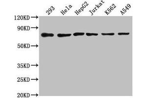 Western Blot Positive WB detected in: 293 whole cell lysate, Hela whole cell lysate, HepG2 whole cell lysate, Jurkat whole cell lysate, K562 whole cell lysate, A549 whole cell lysate All lanes: HSPA8 antibody at 1:2000 Secondary Goat polyclonal to rabbit IgG at 1/50000 dilution Predicted band size: 71, 54 kDa Observed band size: 71 kDa (Hsc70 antibody  (AA 418-597))