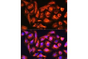 Immunofluorescence (IF) image for anti-B9 Protein Domain 1 (B9D1) (AA 1-130) antibody (ABIN6137409)