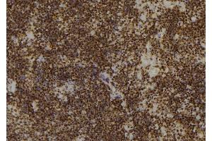 ABIN6266451 at 1/100 staining Mouse spleen tissue by IHC-P. (CDC25A antibody  (pSer76))