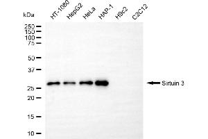 Western blotting analysis using sirtuin 3 antibody (ABIN7800354).