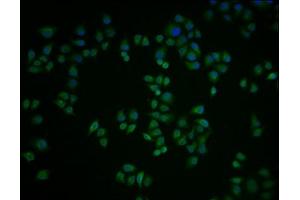 Immunofluorescence staining of Hela cells with ABIN7164665 at 1:100, counter-stained with DAPI. (PIBF1 antibody  (AA 1-757))