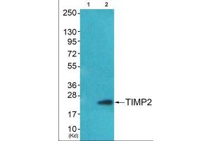 Western blot analysis of extracts from HepG2 cells (Lane 2), using TIMP2 Antibody. (TIMP2 antibody  (Internal Region))