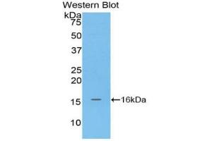 Western blot analysis of the recombinant protein. (MGP antibody  (AA 1-103))