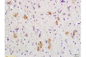 Formalin-fixed and paraffin embedded rat brain tissue labeled with Anti-APC/Adenomatous Polyposis Coli Polyclonal Antibody, Unconjugated  at 1:200 followed by conjugation to the secondary antibody, (SP-0023), and DAB staining (APC antibody  (AA 2751-2843))