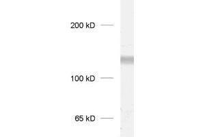 dilution: 1 : 1000, sample: crude synaptosomal fraction of rat brain (P2) (GRIK3 antibody  (C-Term))