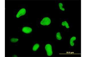 Immunofluorescence of monoclonal antibody to ZNF207 on HeLa cell. (ZNF207 antibody  (AA 1-110))