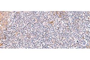 Immunohistochemistry of paraffin-embedded Human tonsil tissue using ITSN2 Polyclonal Antibody at dilution of 1:40(x200)
