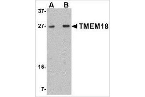 Western blot analysis of TMEM18 in rat brain lysate with TMEM18 antibody at (A) 0.