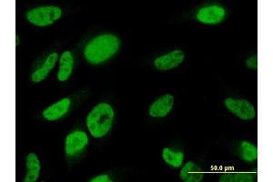 Immunofluorescence of monoclonal antibody to TBX18 on HeLa cell.