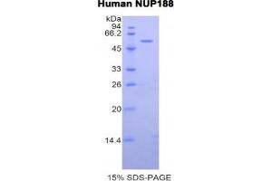 SDS-PAGE analysis of Human Nucleoporin 188 kDa Protein.