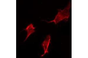ABIN6277355 staining HepG2 by IF/ICC. (Dopamine Receptor d1 antibody  (N-Term))
