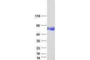 Validation with Western Blot (CEACAM16 Protein (Myc-DYKDDDDK Tag))