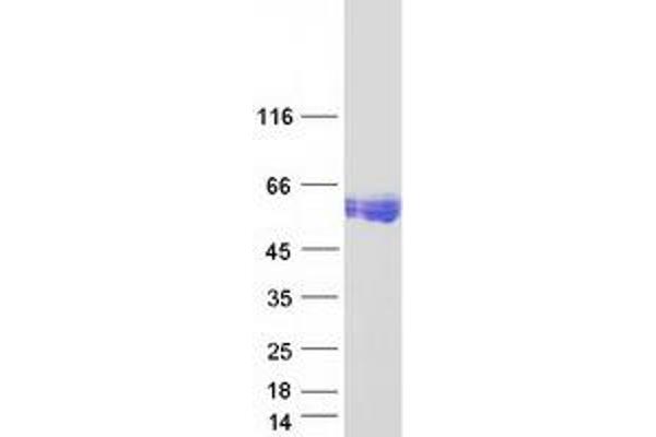 CEACAM16 Protein (Myc-DYKDDDDK Tag)