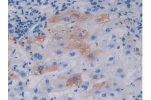 ABCA1 antibody  (AA 1385-1663)