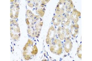 Immunohistochemistry of paraffin-embedded Human stomach using MRPL11 Polyclonal Antibody at dilution of 1:100 (40x lens). (MRPL11 antibody)