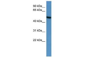 WB Suggested Anti-CERKL Antibody Titration: 0. (CERKL antibody  (C-Term))