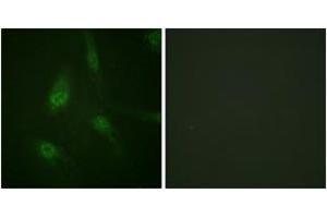 Immunofluorescence analysis of HeLa cells, using NFAT4 (Phospho-Ser165) Antibody. (NFATC3 antibody  (pSer165))