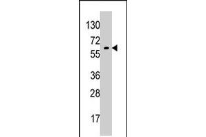 Western blot analysis of GPC6 polyclonal antibody  in K-562 cell line lysates (35 ug/lane). (Glypican 6 antibody  (AA 24-46))