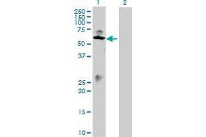 Western Blot analysis of SMAD1 expression in transfected 293T cell line by SMAD1 MaxPab polyclonal antibody. (SMAD1 antibody  (AA 1-465))