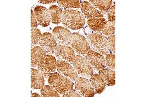 Paraformaldehyde-fixed, paraffin embedded human skeletal muscle tissue, Antigen retrieval by boiling in sodium citrate buffer (pH6. (Raptor antibody)