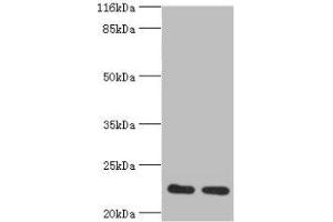 Western blot All lanes: RERG antibody at 2 μg/mL Lane 1: Mouse thymus tissue Lane 2: Rat lung tissue Secondary Goat polyclonal to rabbit at 1/10000 dilution Predicted band size: 23, 21 kDa Observed band size: 23 kDa (RERG antibody  (AA 1-199))