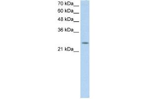 WB Suggested Anti-C5orf4 Antibody Titration:  0. (C5ORF4 antibody  (N-Term))