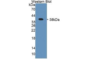 Detection of Recombinant APPBP1, Human using Polyclonal Antibody to Amyloid Beta Precursor Protein Binding Protein 1 (APPBP1) (Amyloid beta Precursor Protein Binding Protein 1 (AA 229-534) antibody)