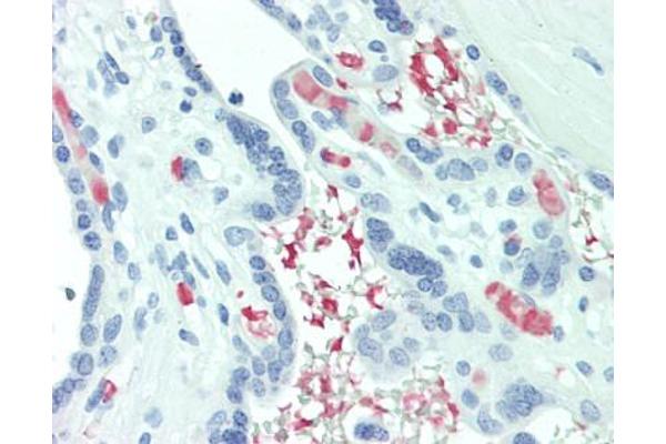 ABHD12B antibody  (C-Term)
