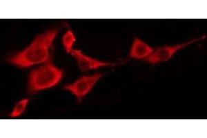 ABIN6276227 staining LOVO by IF/ICC. (TAS2R5 antibody  (Internal Region))