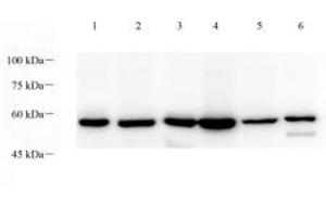 Western blot analysis of p38IP (ABIN7075954) at dilution of 1: 1000,Lane 1: Mouse testis tissue lysate,Lane 2: Mouse thymus tissue lysate,Lane 3: Mouse lung tissue lysate,Lane 4: Rat testis tissue lysate,Lane 5: Rat thymus tissue lysate,Lane 6: Rat lung tissue lysate (Transcription Factor SPT20 Homolog (SUPT20H) antibody)