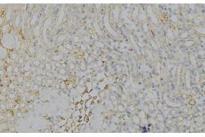 ABIN6276781 at 1/100 staining Human gastric tissue by IHC-P. (HMGCR antibody  (N-Term))