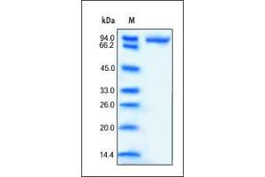 Human CD14, Fc Tag on SDS-PAGE under reducing (R) condition. (CD14 Protein (CD14) (AA 20-352) (Fc Tag))