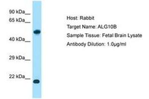 ALG10B anticorps  (AA 104-153)