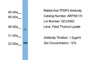 WB Suggested Anti-TFDP3  Antibody Titration: 0. (TFDP3 antibody  (N-Term))