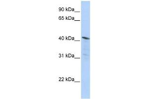 HDAC11 antibody used at 1 ug/ml to detect target protein. (HDAC11 antibody  (Middle Region))