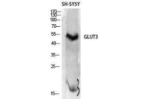 Western Blotting (WB) image for anti-Solute Carrier Family 2 (Facilitated Glucose Transporter), Member 3 (SLC2A3) (C-Term) antibody (ABIN3175292) (SLC2A3 antibody  (C-Term))