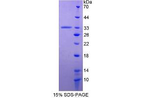 Image no. 1 for Apolipoprotein A-I Binding Protein (APOA1BP) (AA 20-288) protein (His tag) (ABIN4989988)