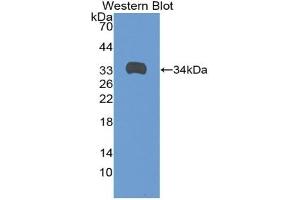 Detection of Recombinant ANGPTL1, Rat using Polyclonal Antibody to Angiopoietin-3 (ANG-3) (Angiopoietin 4 antibody  (AA 36-297))
