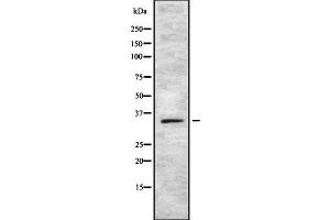 SOX12 antibody  (Internal Region)