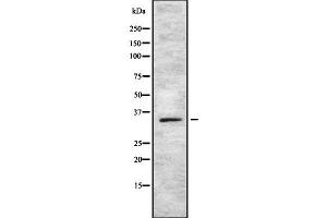Western blot analysis SOX12 using COLO205 whole cell lysates (SOX12 antibody  (Internal Region))