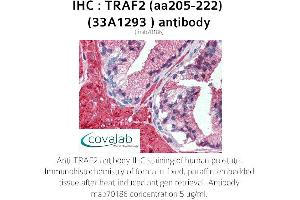 Image no. 1 for anti-TNF Receptor-Associated Factor 2 (TRAF2) (AA 205-222) antibody (ABIN5693735) (TRAF2 antibody  (AA 205-222))