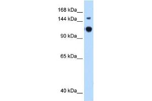 GAPVD1 antibody used at 0. (GAPVD1 antibody  (N-Term))