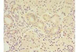 Immunohistochemistry of paraffin-embedded human pancreatic tissue using ABIN7159340 at dilution of 1:100 (FAM174A antibody  (AA 41-123))