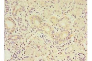 Immunohistochemistry of paraffin-embedded human pancreatic tissue using ABIN7159340 at dilution of 1:100 (FAM174A antibody  (AA 41-123))