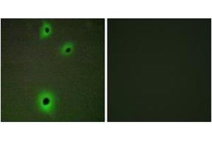 Immunofluorescence analysis of A549 cells, using CADM4 Antibody.